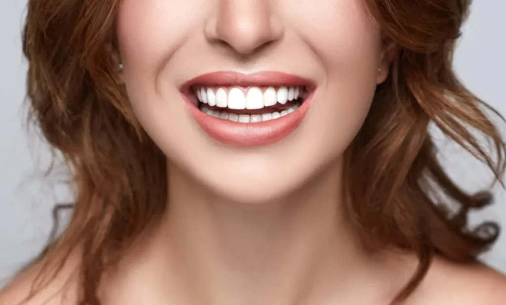 5 Simple Ways to Improve Your Smile 